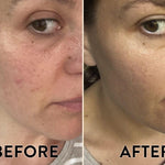 CBD Superboost Face Oil before and after photos